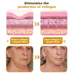 Load image into Gallery viewer, BeeTox™ - Bee Venom Wrinkle Repair Cream (Buy 1 Get 1 Free 🔥)
