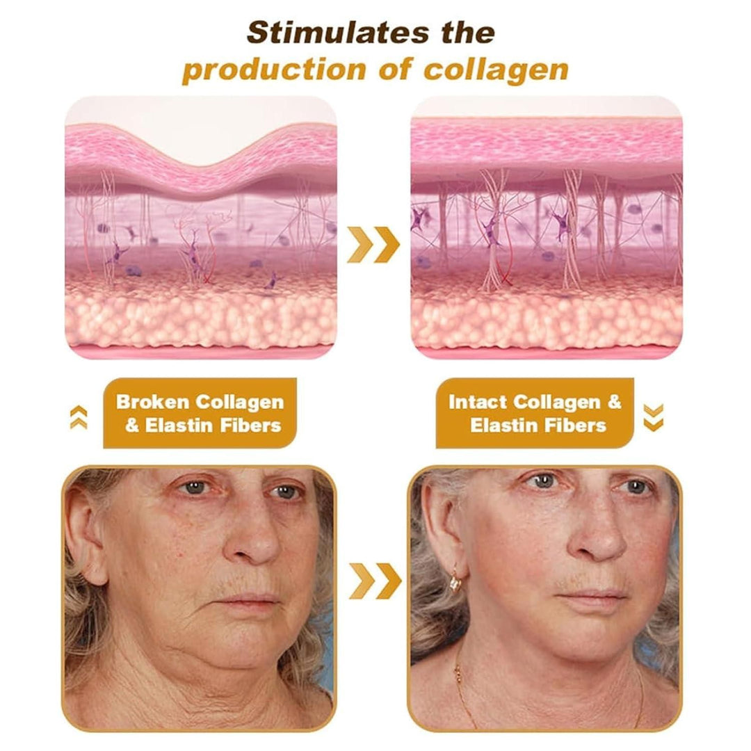 BeeTox™ - Bee Venom Wrinkle Repair Cream (Buy 1 Get 1 Free 🔥)