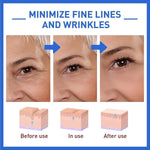 Load image into Gallery viewer, Botox Anti-Aging Serum (Buy 1 Get 1 FREE🔥)
